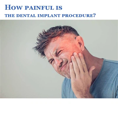 Què tan dolorós és el procediment d'implant dental?