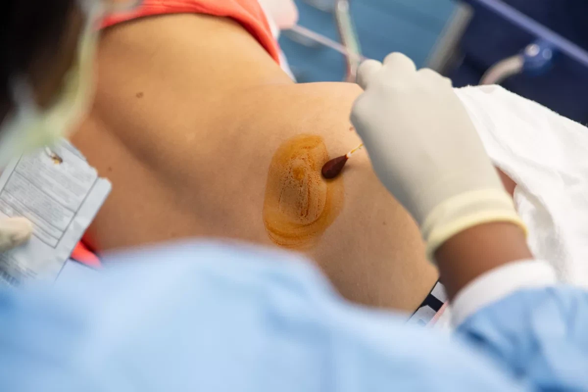 Biòpsia de medul·la òssia explicada: procediment, usos i recuperació