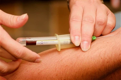Spinal Needle + fabricant: tendències de la indústria i perspectives de repte...